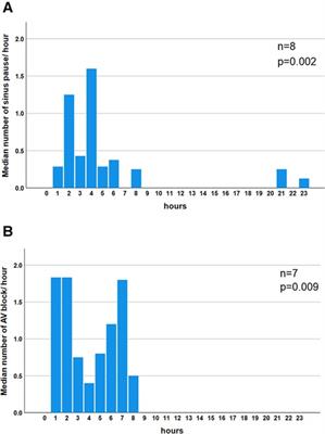 Age-related reference intervals for ambulatory electrocardiographic parameters in healthy individuals